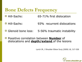Bone Defects Frequency
 Hill-Sachs: 65-71% first dislocation
 Hill-Sachs: 93% recurrent dislocations
 Glenoid bone loss: 5-56% traumatic instability
 Possitive correlation between Number of
dislocations and depth/extend of the lesions
Lynch JR, J Shoulder Elbow Surg (2009) 18, 317-328
www.shoulder.gr
 