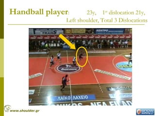 Handball player: 23y, 1st
dislocation 21y,
Left shoulder, Total 3 Dislocations
www.shoulder.gr
 
