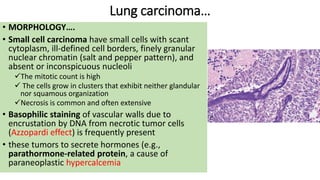 8 Lung tumors and cancers of respiratory .pdf