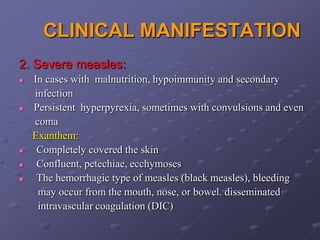 CLINICAL MANIFESTATION
2. Severe measles:
   In cases with malnutrition, hypoimmunity and secondary
    infection
   Persistent hyperpyrexia, sometimes with convulsions and even
    coma
    Exanthem:
    Completely covered the skin
    Confluent, petechiae, ecchymoses
    The hemorrhagic type of measles (black measles), bleeding
     may occur from the mouth, nose, or bowel. disseminated
     intravascular coagulation (DIC)
 