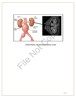 pg. 36
Artificial Kidney Manufacturing Medical Textile
File
N
otC
opy
 