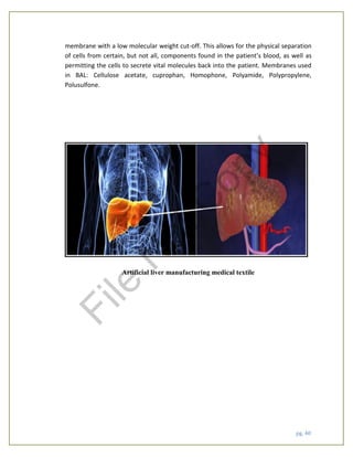 pg. 40
membrane with a low molecular weight cut-off. This allows for the physical separation
of cells from certain, but not all, components found in the patient’s blood, as well as
permitting the cells to secrete vital molecules back into the patient. Membranes used
in BAL: Cellulose acetate, cuprophan, Homophone, Polyamide, Polypropylene,
Polusulfone.
Artificial liver manufacturing medical textile
File
N
otC
opy
 