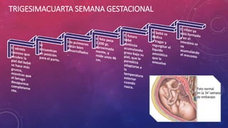 TRIGESIMACUARTA SEMANA GESTACIONAL
 