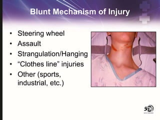 Strangulation Injury 8_Neck Trauma.pptx