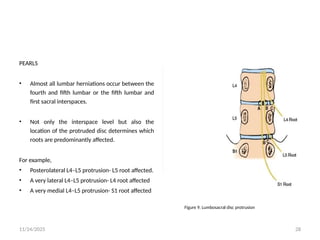 8_Neuroanatomy_and_Neurolocalization_of_Roots_and_Plexuses_Final.pptx