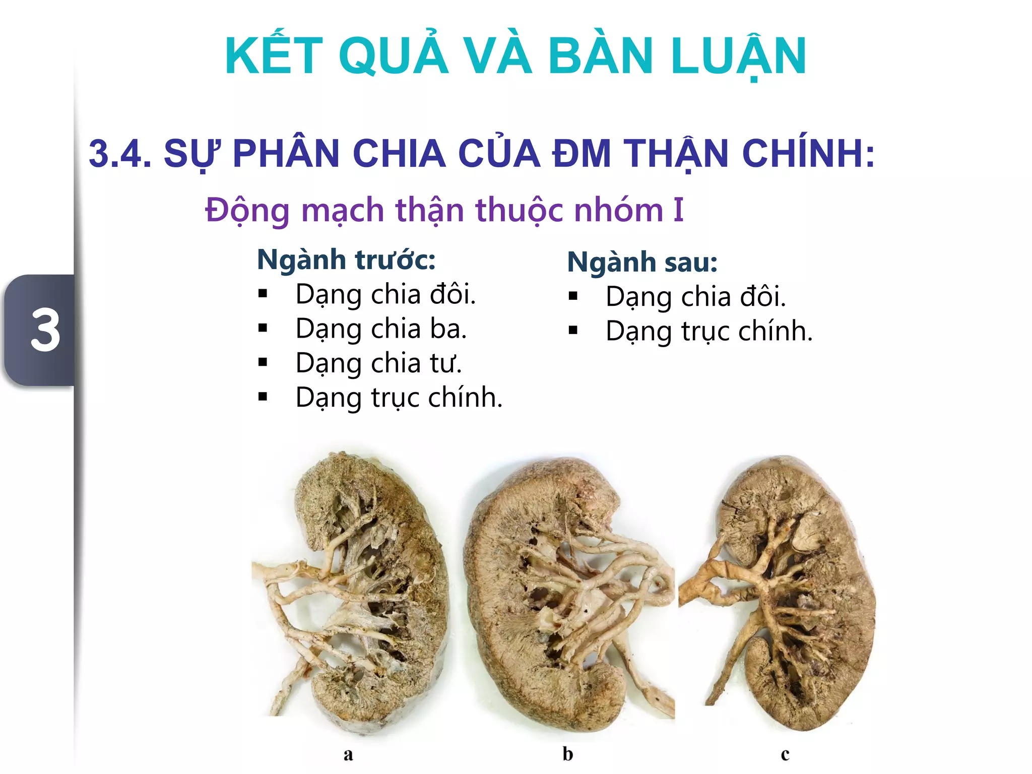 MỘT SỐ ĐẶC ĐIỂM GIẢI PHẪU ĐỘNG MẠCH THẬN ĐOẠN NGOÀI NHU MÔ Ở NGƯỜI VIỆT ...