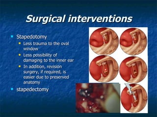 Surgical interventions Stapedotomy Less trauma to the oval window Less possibility of damaging to the inner ear In addition, revision surgery, if required, is easier due to preserved anatomy stapedectomy 