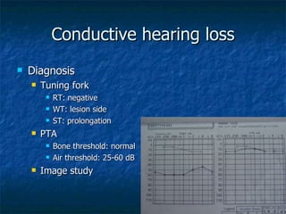 Conductive hearing loss Diagnosis  Tuning fork RT: negative WT: lesion side ST: prolongation PTA Bone threshold: normal  Air threshold: 25-60 dB Image study 