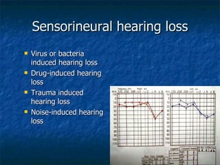Sensorineural hearing loss Virus or bacteria induced hearing loss Drug-induced hearing loss Trauma induced hearing loss Noise-induced hearing loss 