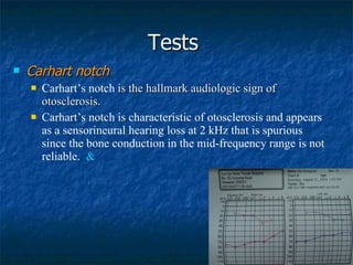 Tests  Carhart notch   Carhart’s notch  is the hallmark audiologic sign of otosclerosis.  Carhart’s notch is characteristic of otosclerosis and appears as a sensorineural hearing loss at 2 kHz that is spurious since the bone conduction in the mid-frequency range is not reliable.  & 