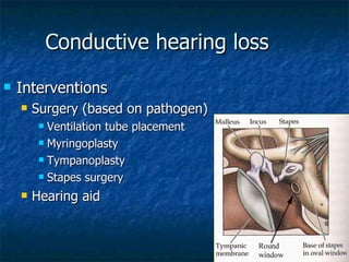 Conductive hearing loss Interventions Surgery (based on pathogen) Ventilation tube placement Myringoplasty Tympanoplasty Stapes surgery Hearing aid 
