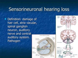 Sensorineuronal hearing loss Definition: damage of hair cell, stria vacular, spinal ganglion neuron, auditory nerve and central auditory system. Pathogen 