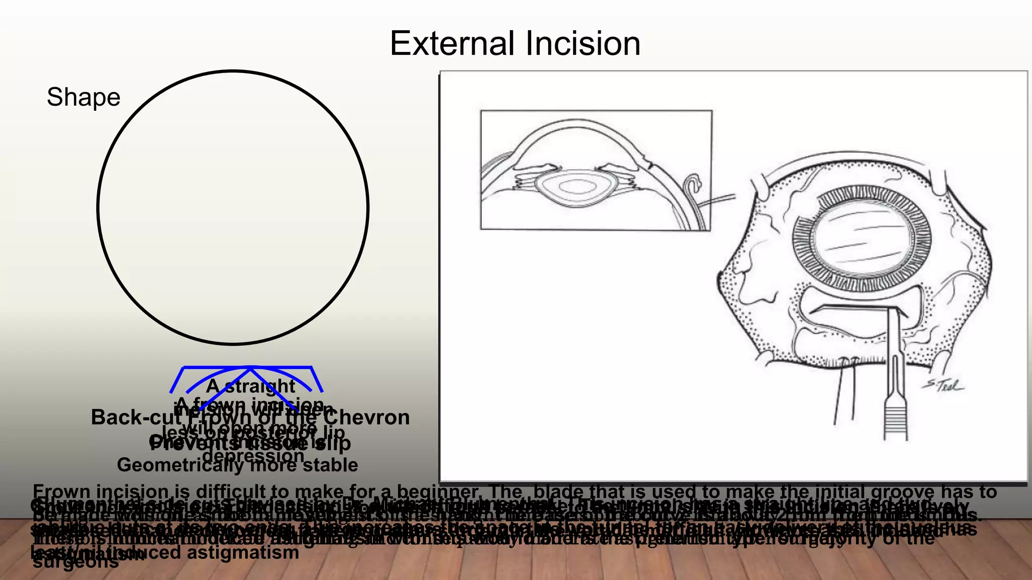 SICS WOUND CONSTRUCTION _ Beginner's Guide | PPTX