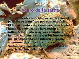 Ácaro de la sarna
• Comúnmente conocido por su picazón, el
parásito se transfiere por contacto físico.
• El ácaro hembra deja sus huevos en la piel
humana, provocando la reacción e
inflamación. Esto se agrava cuando la
hembra comienza enterrar los huevos bajo la
piel produciendo una intensa picazón,
comúnmente conocido como sarna.
• Síntomas: picor, dolor, nódulos llenos de
pus, irritación de la piel .
 