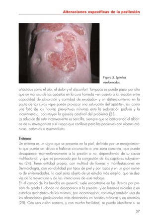 Cuidados de la Piel Perilesional
