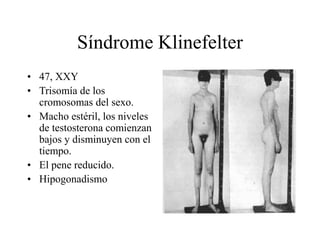 Síndrome Klinefelter
• 47, XXY
• Trisomía de los
cromosomas del sexo.
• Macho estéril, los niveles
de testosterona comienzan
bajos y disminuyen con el
tiempo.
• El pene reducido.
• Hipogonadismo
 