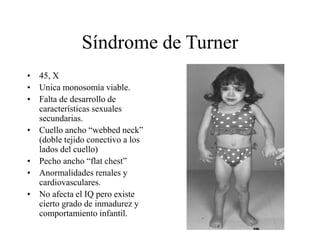 Síndrome de Turner
• 45, X
• Unica monosomía viable.
• Falta de desarrollo de
características sexuales
secundarias.
• Cuello ancho “webbed neck”
(doble tejido conectivo a los
lados del cuello)
• Pecho ancho “flat chest”
• Anormalidades renales y
cardiovasculares.
• No afecta el IQ pero existe
cierto grado de inmadurez y
comportamiento infantil.
 