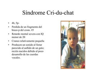 Síndrome Cri-du-chat
• 46, 5p-
• Perdida de un fragmento del
brazo p del crom. #5
• Retardo mental severa con IQ
menor de 20
• Craneo relativamente pequeña
• Producen un sonido al llorar
parecido al aullido de un gato;
recién nacidos debido al poco
desarrollo de las cuerdas
vocales.
 