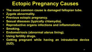 Postpartum Hemorrhage (PPH) and Ectopic Pregnancy Slide 23