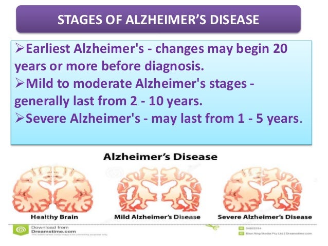 Alzheimer's disease
