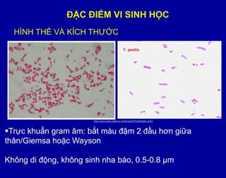 ĐẶC ĐIỂM VI SINH HỌC
HÌNH THỂ VÀ KÍCH THƢỚC
Trực khuẩn gram âm: bắt màu đậm 2 đầu hơn giữa
thân/Giemsa hoặc Wayson
Không di động, không sinh nha bào, 0.5-0.8 µm
http://www.dshs.state.tx.us/lab/eprBTfactSheets.shtm
 
