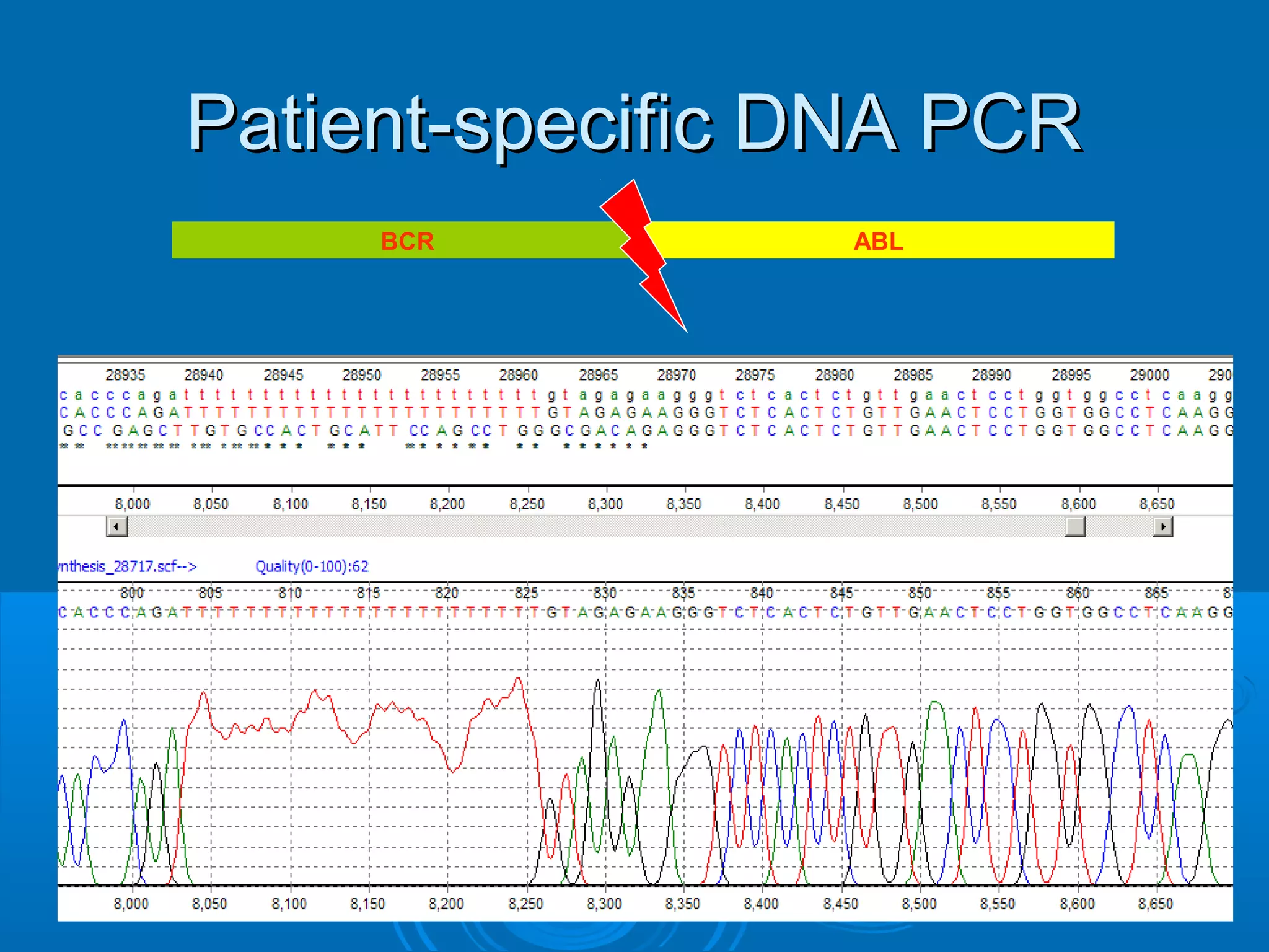 Patient-specific DNA PCRPatient-specific DNA PCR
BCR ABL
 