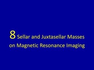 8Sellar and Juxtasellar Masses
on Magnetic Resonance Imaging
 