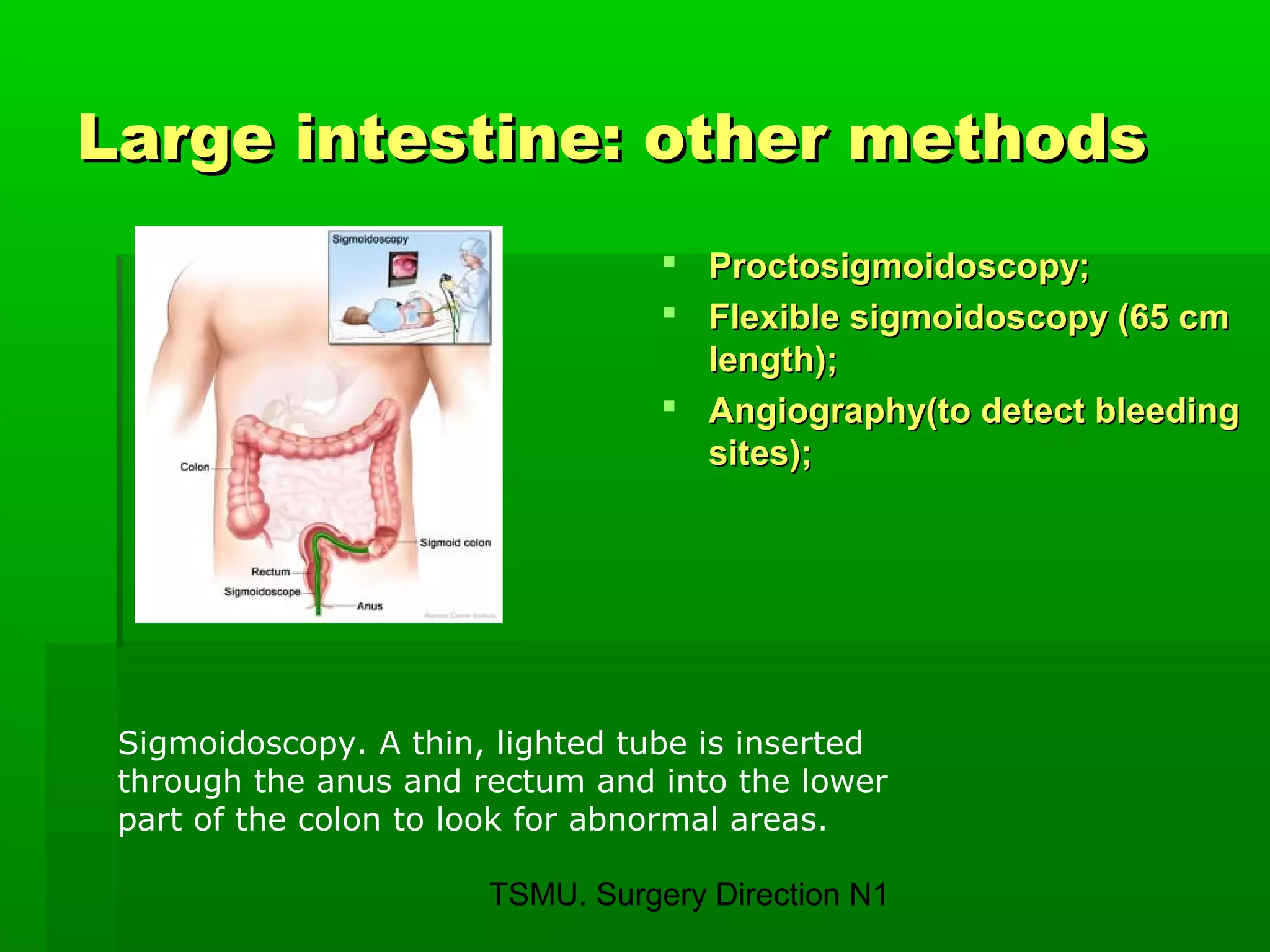 TSMU. Surgery Direction N1
Large intestine: other methodsLarge intestine: other methods
 Proctosigmoidoscopy;Proctosigmoidoscopy;
 Flexible sigmoidoscopy (65 cmFlexible sigmoidoscopy (65 cm
length);length);
 Angiography(to detect bleedingAngiography(to detect bleeding
sites);sites);
Sigmoidoscopy. A thin, lighted tube is inserted
through the anus and rectum and into the lower
part of the colon to look for abnormal areas.
 