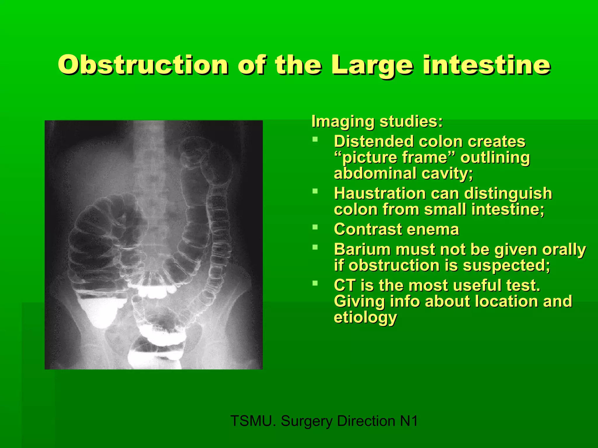 TSMU. Surgery Direction N1
Obstruction of the Large intestineObstruction of the Large intestine
Imaging studies:Imaging studies:
 Distended colon createsDistended colon creates
“picture frame” outlining“picture frame” outlining
abdominal cavity;abdominal cavity;
 Haustration can distinguishHaustration can distinguish
colon from small intestine;colon from small intestine;
 Contrast enemaContrast enema
 Barium must not be given orallyBarium must not be given orally
if obstruction is suspected;if obstruction is suspected;
 CT is the most useful test.CT is the most useful test.
Giving info about location andGiving info about location and
etiologyetiology
 