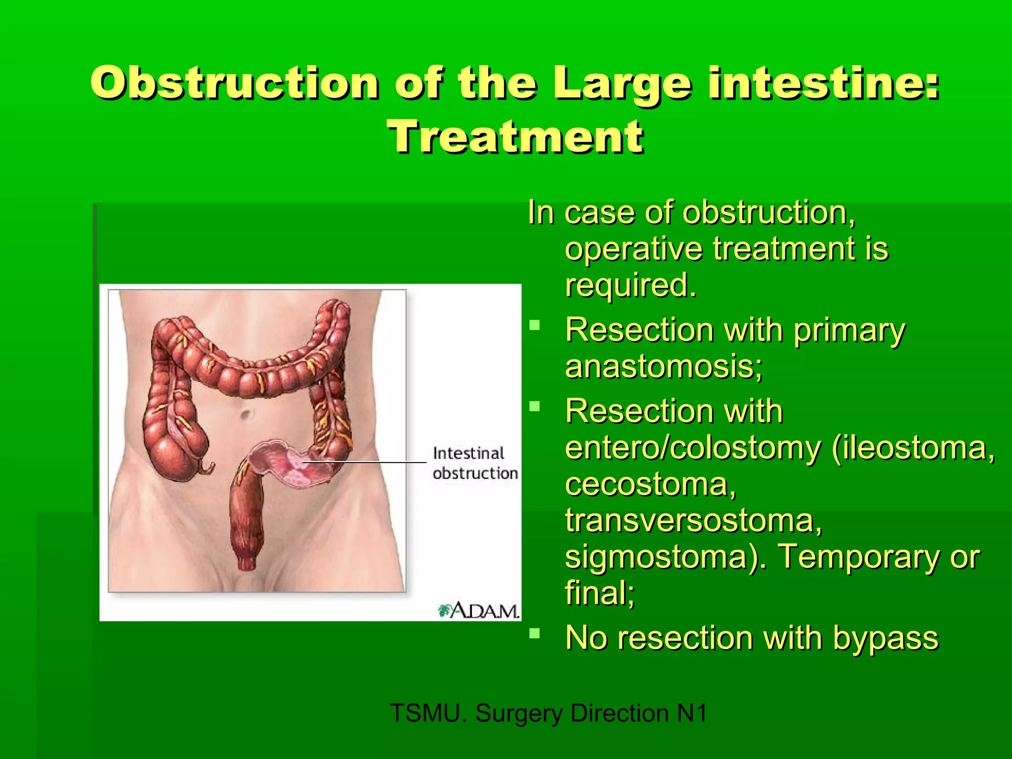 TSMU. Surgery Direction N1
Obstruction of the Large intestine:Obstruction of the Large intestine:
TreatmentTreatment
In case of obstruction,In case of obstruction,
operative treatment isoperative treatment is
required.required.
 Resection with primaryResection with primary
anastomosis;anastomosis;
 Resection withResection with
entero/colostomy (ileostoma,entero/colostomy (ileostoma,
cecostoma,cecostoma,
transversostoma,transversostoma,
sigmostoma). Temporary orsigmostoma). Temporary or
final;final;
 No resection with bypassNo resection with bypass
 