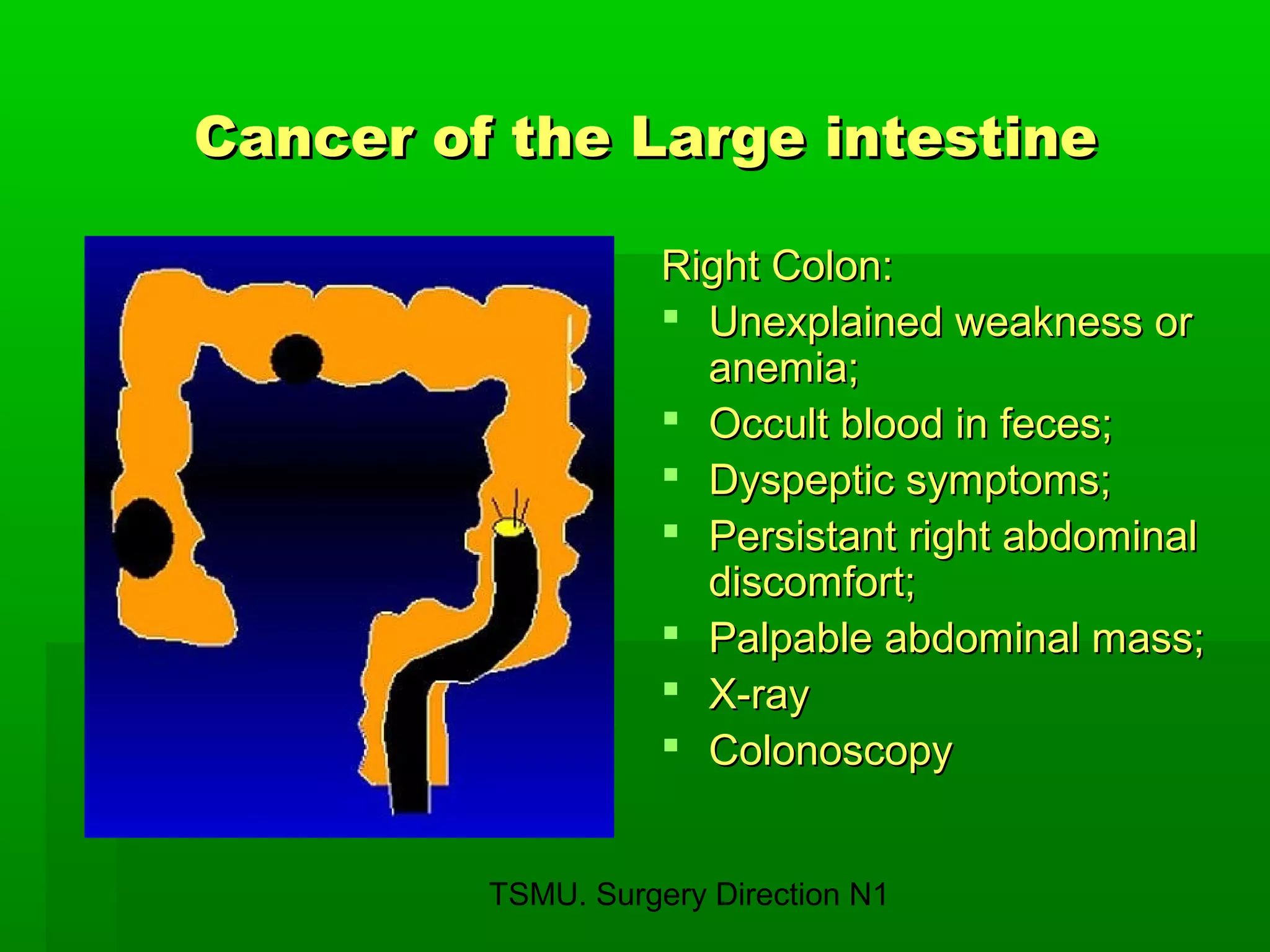 TSMU. Surgery Direction N1
Cancer of the Large intestineCancer of the Large intestine
Right Colon:Right Colon:
 Unexplained weakness orUnexplained weakness or
anemia;anemia;
 Occult blood in feces;Occult blood in feces;
 Dyspeptic symptoms;Dyspeptic symptoms;
 Persistant right abdominalPersistant right abdominal
discomfort;discomfort;
 Palpable abdominal mass;Palpable abdominal mass;
 X-rayX-ray
 ColonoscopyColonoscopy
 