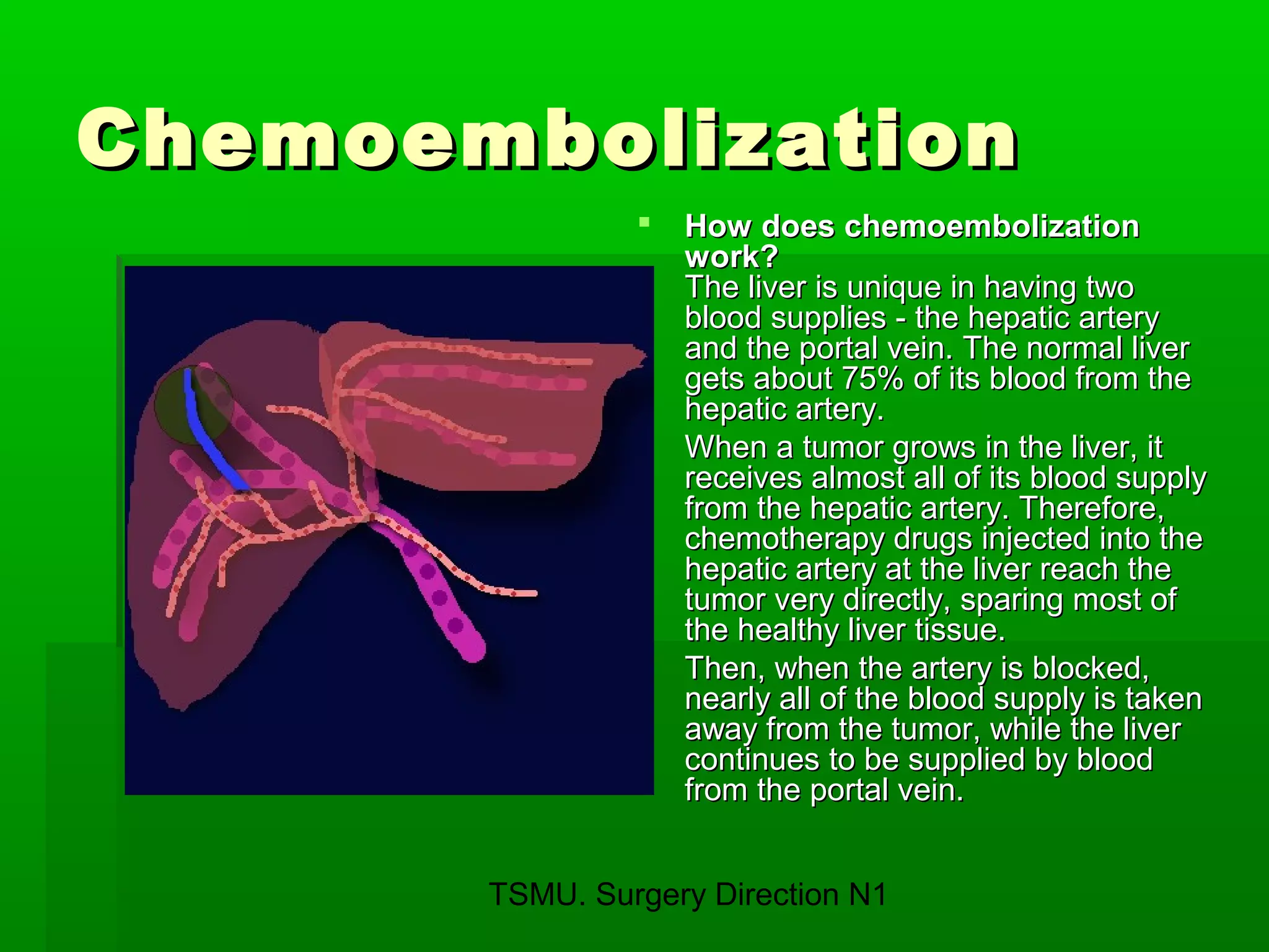 TSMU. Surgery Direction N1
ChemoembolizationChemoembolization
 How does chemoembolizationHow does chemoembolization
work?work?
The liver is unique in having twoThe liver is unique in having two
blood supplies - the hepatic arteryblood supplies - the hepatic artery
and the portal vein. The normal liverand the portal vein. The normal liver
gets about 75% of its blood from thegets about 75% of its blood from the
hepatic artery.hepatic artery.
 When a tumor grows in the liver, itWhen a tumor grows in the liver, it
receives almost all of its blood supplyreceives almost all of its blood supply
from the hepatic artery. Therefore,from the hepatic artery. Therefore,
chemotherapy drugs injected into thechemotherapy drugs injected into the
hepatic artery at the liver reach thehepatic artery at the liver reach the
tumor very directly, sparing most oftumor very directly, sparing most of
the healthy liver tissue.the healthy liver tissue.
 Then, when the artery is blocked,Then, when the artery is blocked,
nearly all of the blood supply is takennearly all of the blood supply is taken
away from the tumor, while the liveraway from the tumor, while the liver
continues to be supplied by bloodcontinues to be supplied by blood
from the portal vein.from the portal vein.
 