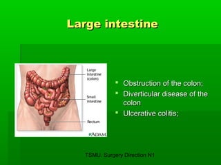 TSMU. Surgery Direction N1
Large intestineLarge intestine
 Obstruction of the colon;Obstruction of the colon;
 Diverticular disease of theDiverticular disease of the
coloncolon
 Ulcerative colitis;Ulcerative colitis;
 