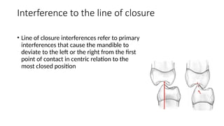 8th lec. Occlusal Equilibration.....pptx