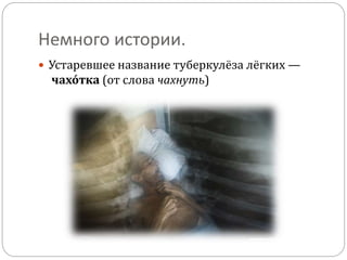 Немного истории.
 Устаревшее название туберкулёза лёгких —
чахо́тка (от слова чахнуть)
 