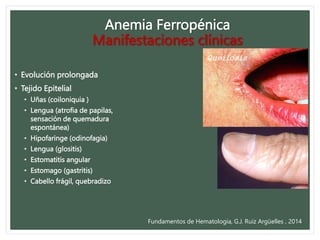 Anemia_Ferropenica_BUAP.pptx