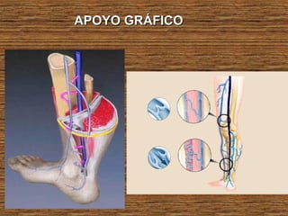 APOYO GRÁFICOAPOYO GRÁFICO
 