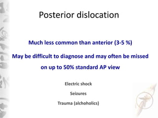 Posterior dislocation
Much less common than anterior (3-5 %)
May be difficult to diagnose and may often be missed
on up to...