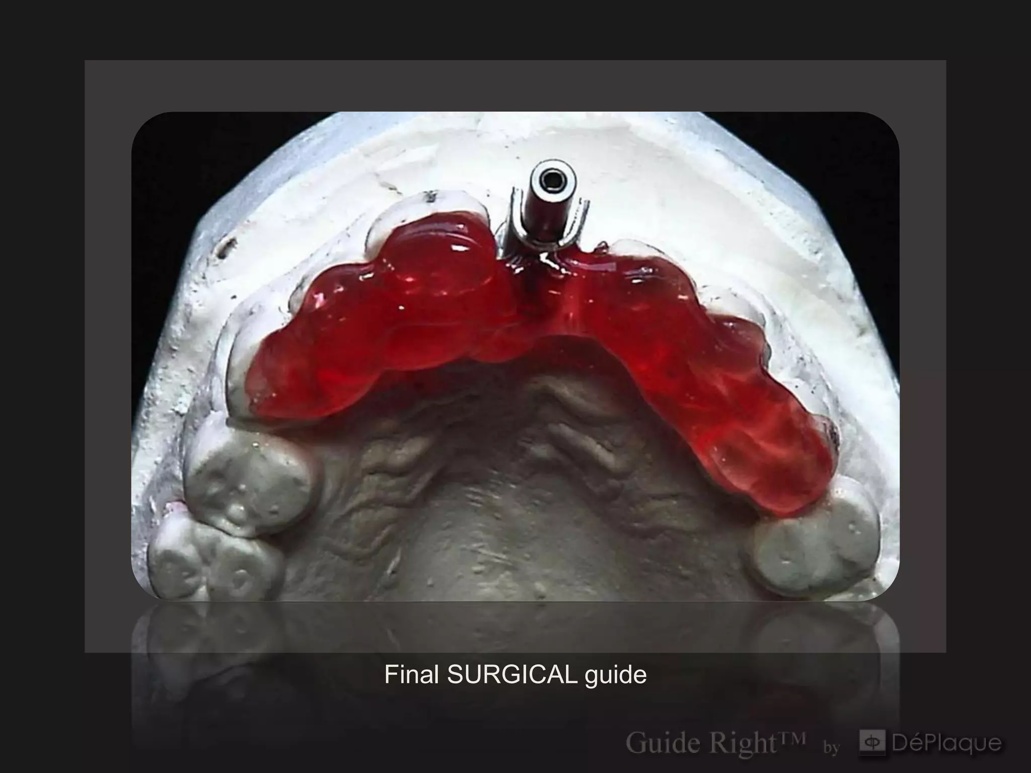 Final SURGICAL guide
 