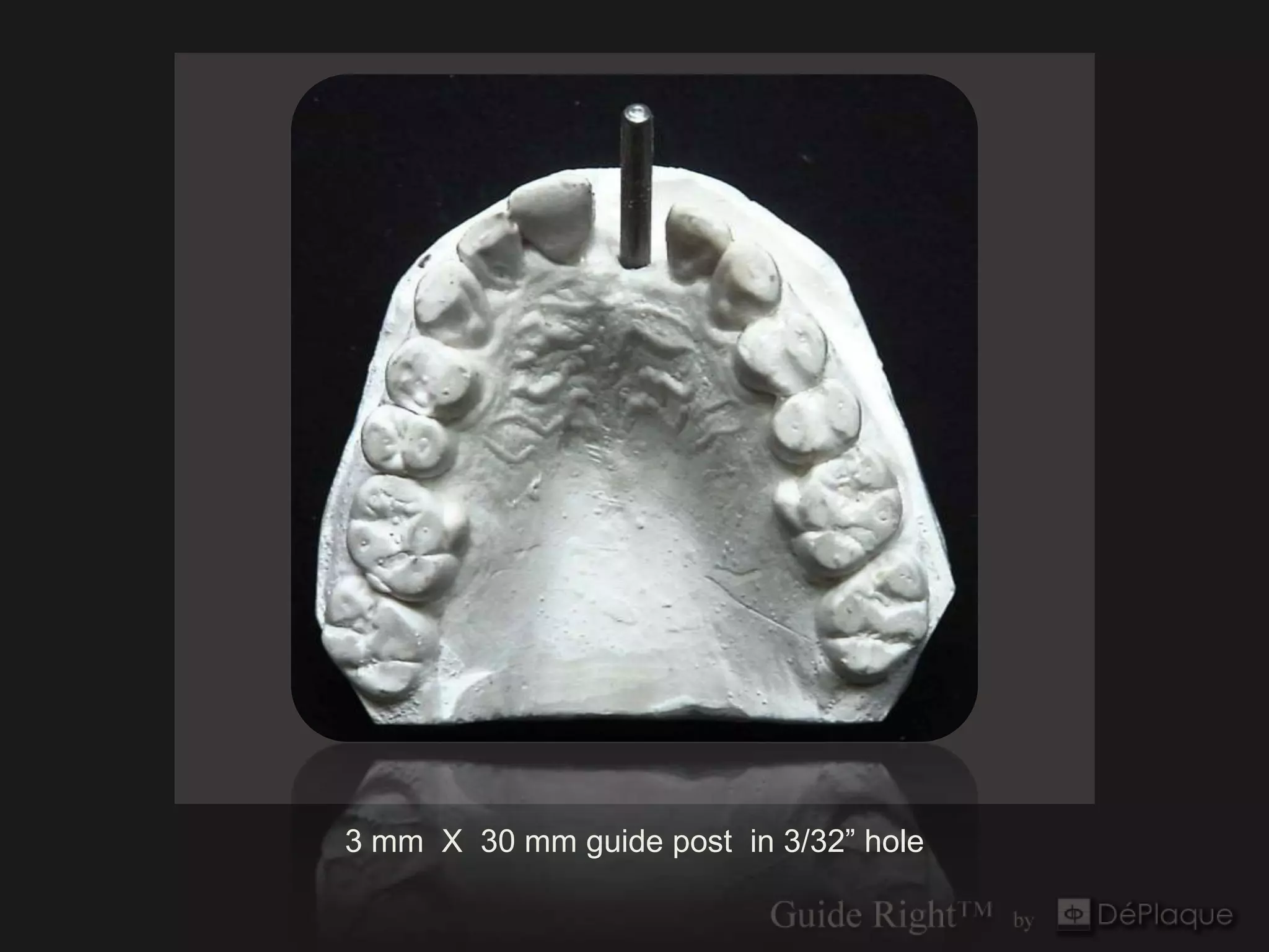 3 mm X 30 mm guide post in 3/32” hole
 