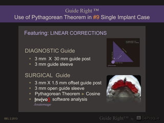 Guide Right ™
       Use of Pythagorean Theorem in #9 Single Implant Case

             Featuring: LINEAR CORRECTIONS


             DIAGNOSTIC Guide
               3 mm X 30 mm guide post
               3 mm guide sleeve

             SURGICAL Guide
                 3 mm X 1.5 mm offset guide post
                 3 mm open guide sleeve
                 Pythagorean Theorem ► Cosine
                 Invivo5 software analysis
                  Anatomage



BEL 2.2013
 