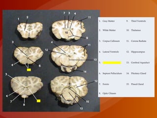 1. Gray Matter 9. Third Ventricle
2. White Matter 10. Thalamus
3. Corpus Callosum 11. Corona Radiata
4. Lateral Ventricle 12. Hippocampus
5. Caudate Nucleus 13. Cerebral Aqueduct
6. Septum Pellucidum 14. Pituitary Gland
7. Fornix 15. Pineal Gland
8. Optic Chiasm
 