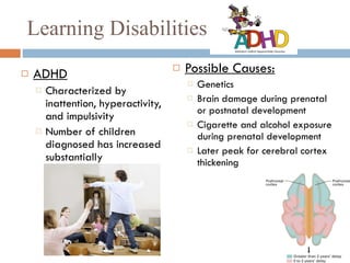Learning Disabilities ADHD Characterized by inattention, hyperactivity, and impulsivity  Number of children diagnosed has increased substantially Possible Causes: Genetics Brain damage during prenatal or postnatal development Cigarette and alcohol exposure during prenatal development Later peak for cerebral cortex thickening 