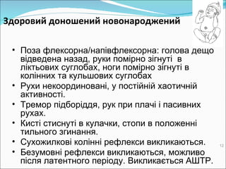 Здоровий доношений  н овонароджений  Поза флексорна / напівфлексорна: голова дещо відведена назад, руки помірно зігнуті  в ліктьових суглобах, ноги помірно зігнуті в колінних та кульшових суглобах  Рухи некоординовані, у постійній хаотичній активності.  Тремор підборіддя, рук при плачі і пасивних рухах.  Кисті стиснуті в кулачки, стопи в положенні тильного згинання.  Сухожилкові колінні рефлекси викликаються.  Безумовні рефлекси викликаються, можливо після латентного періоду. Викликається АШТР.  