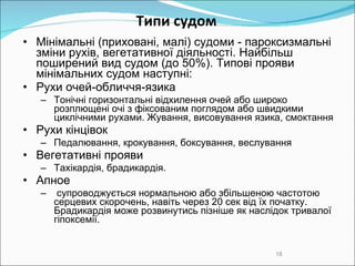 Типи  судом Мінімальні ( приховані, малі )  судоми - п ароксизмальні зміни рухів, вегетативної діяльності.  Н айбільш поширений вид  судом   ( до 50% ) .  Т ипові прояви  мінімальних  судом  наступні: Рухи очей-обличчя-язика  Тонічні горизонтальні відхилення очей або широко розплющені очі з фіксованим поглядом або швидкими циклічними рухами.   Жування, висовування язика, смоктання  Рухи кінцівок  Педалювання, крокування, боксування, веслування  Вегетативні прояви  Тахікардія, брадикардія.  Апное  супроводжується нормальною або збільшеною частотою серцевих скорочень, навіть через   20 сек від їх початку. Брадикардія може розвинутись пізніше як наслідок тривалої гіпоксемії. 