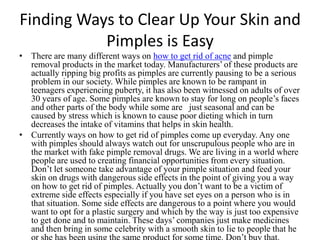 Finding Ways to Clear Up Your Skin and Pimples is Easy There are many different ways on how to get rid of acne and pimple removal products in the market today. Manufacturers’ of these products are actually ripping big profits as pimples are currently pausing to be a serious problem in our society. While pimples are known to be rampant in teenagers experiencing puberty, it has also been witnessed on adults of over 30 years of age. Some pimples are known to stay for long on people’s faces and other parts of the body while some are   just seasonal and can be caused by stress which is known to cause poor dieting which in turn decreases the intake of vitamins that helps in skin health. Currently ways on how to get ridof pimples come up everyday. Any one with pimples should always watch out for unscrupulous people who are in the market with fake pimple removal drugs. We are living in a world where people are used to creating financial opportunities from every situation. Don’t let someone take advantage of your pimple situation and feed your skin on drugs with dangerous side effects in the point of giving you a way on how to get rid of pimples. Actually you don’t want to be a victim of extreme side effects especially if you have set eyes on a person who is in that situation. Some side effects are dangerous to a point where you would want to opt for a plastic surgery and which by the way is just too expensive to get done and to maintain. These days’ companies just make medicines and then bring in some celebrity with a smooth skin to lie to people that he or she has been using the same product for some time. Don’t buy that.  