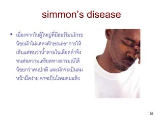 26
simmon’s disease
• เนื่องจากในผู้ใหญ่ที่มีฮอร์โมนโกรธ
น้อยมักไม่แสดงลักษณะอาการให้
เห็นแต่พบว่าน้าตาลในเลือดต่าจึง
ทนต่อความเครียดทางอารมณ์ได้
น้อยกว่าคนปกติ และมักจะเป็นลม
หน้ามืดง่าย อาจเป็นโรคผอมแห้ง
 