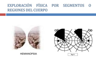 EXPLORACIÓN FÍSICA POR SEGMENTOS O
REGIONES DEL CUERPO
HEMIANOPSIA
 
