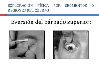 Eversión del párpado superior:
EXPLORACIÓN FÍSICA POR SEGMENTOS O
REGIONES DEL CUERPO
 