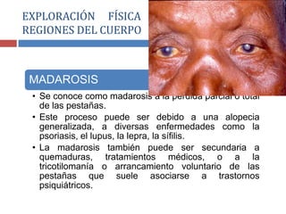 MADAROSIS
• Se conoce como madarosis a la pérdida parcial o total
de las pestañas.
• Este proceso puede ser debido a una alopecia
generalizada, a diversas enfermedades como la
psoriasis, el lupus, la lepra, la sífilis.
• La madarosis también puede ser secundaria a
quemaduras, tratamientos médicos, o a la
tricotilomanía o arrancamiento voluntario de las
pestañas que suele asociarse a trastornos
psiquiátricos.
EXPLORACIÓN FÍSICA POR SEGMENTOS O
REGIONES DEL CUERPO
 
